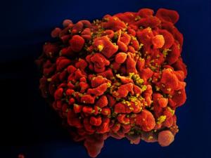 HIV-infected T Cell
